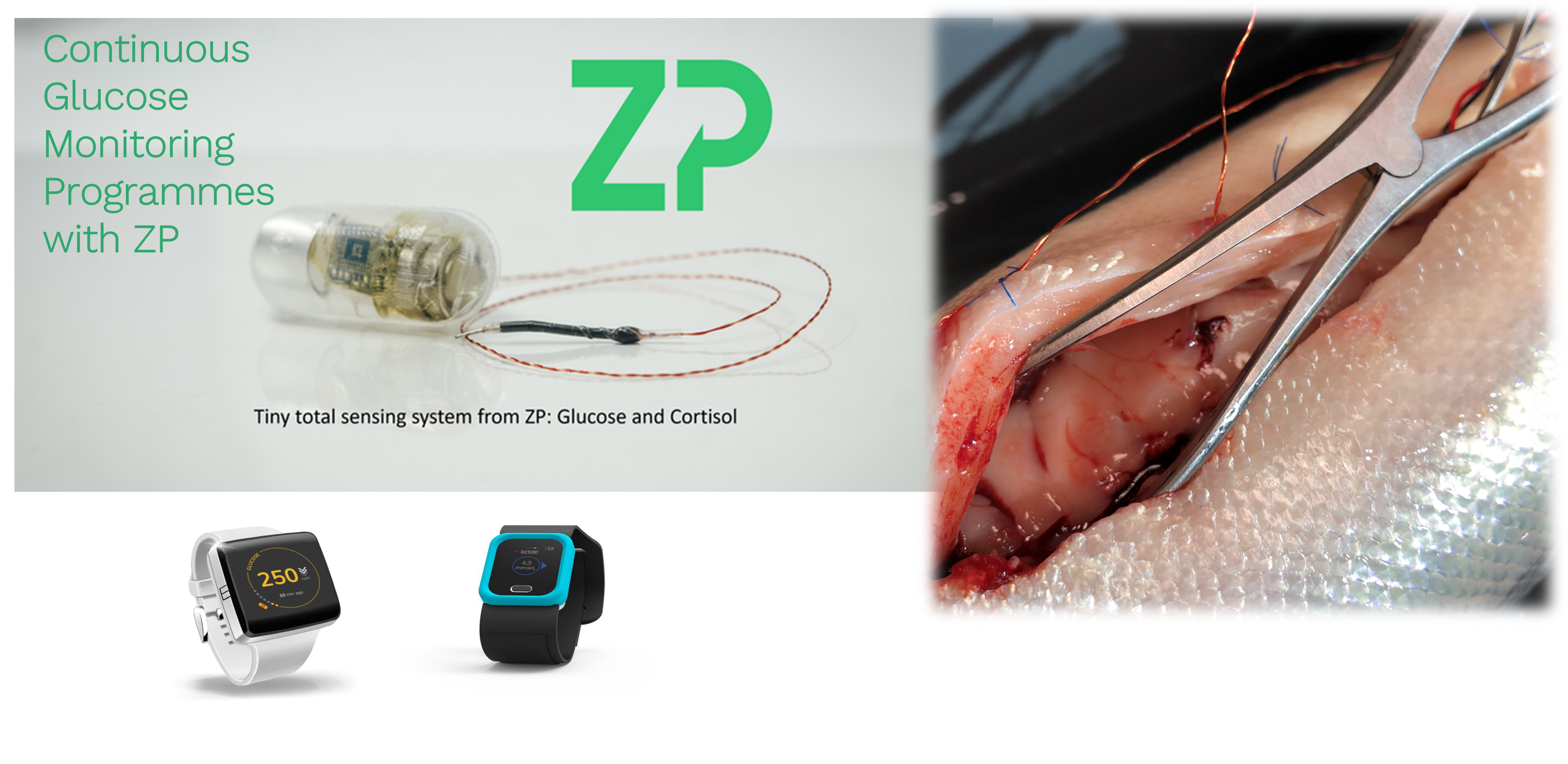 CGM Development and Manufacturing Services from ZP
