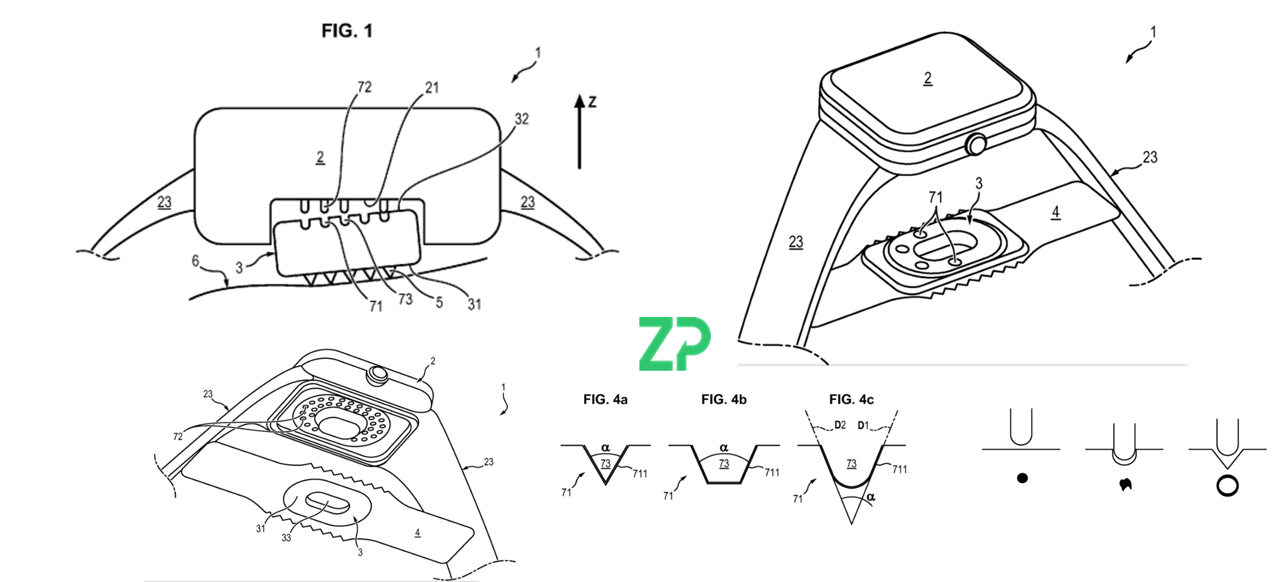 Reliable Signals on Real Skin: Electrical Robustness as a Pillar of ZP’s Wearable Microneedle IP Moat