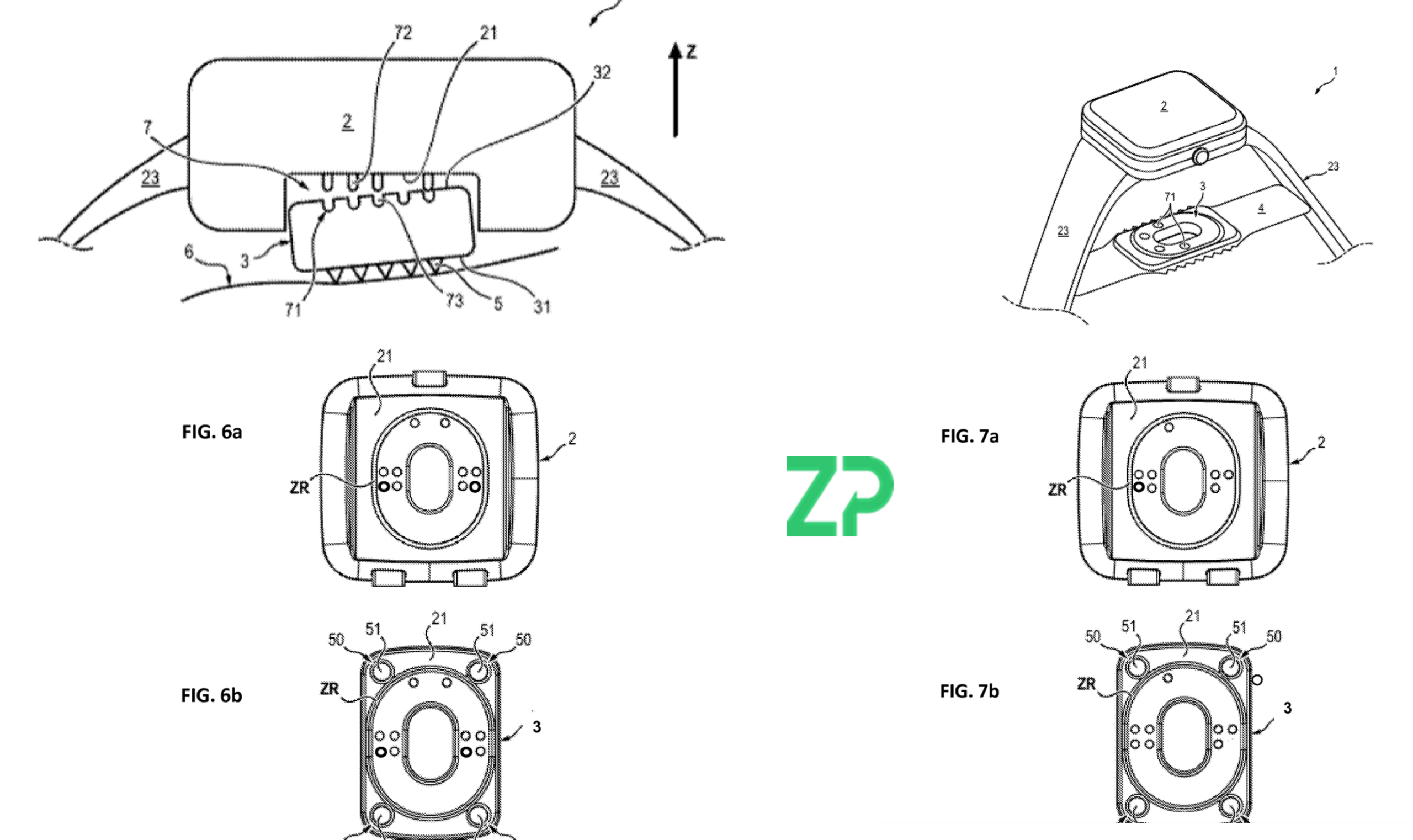 Reliable Signals Start with Reliable Contact: A Core Pillar of ZP’s Wearable Microneedle IP Moat