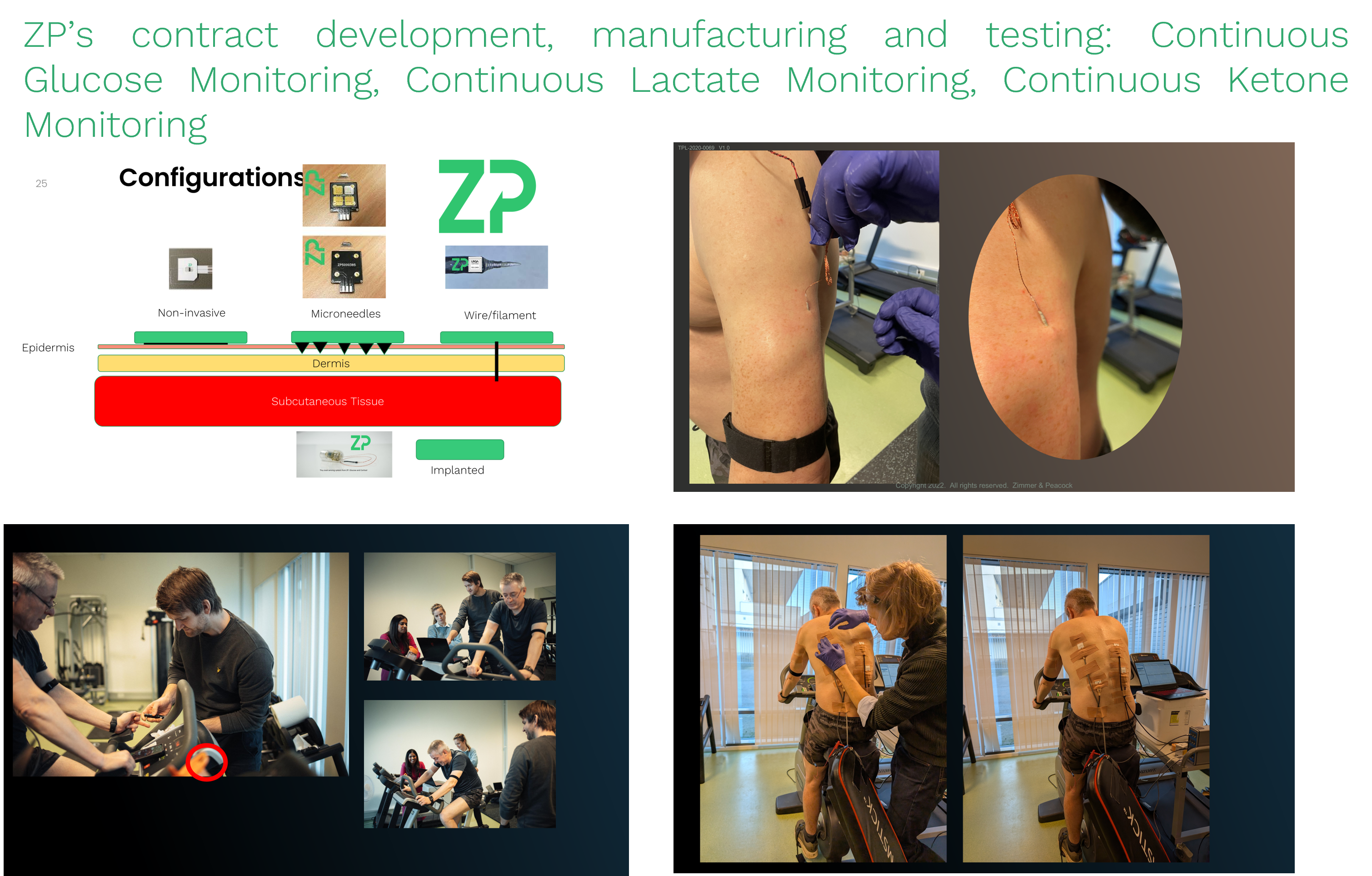 Continuous glucose, ketone and lactate monitoring from ZP