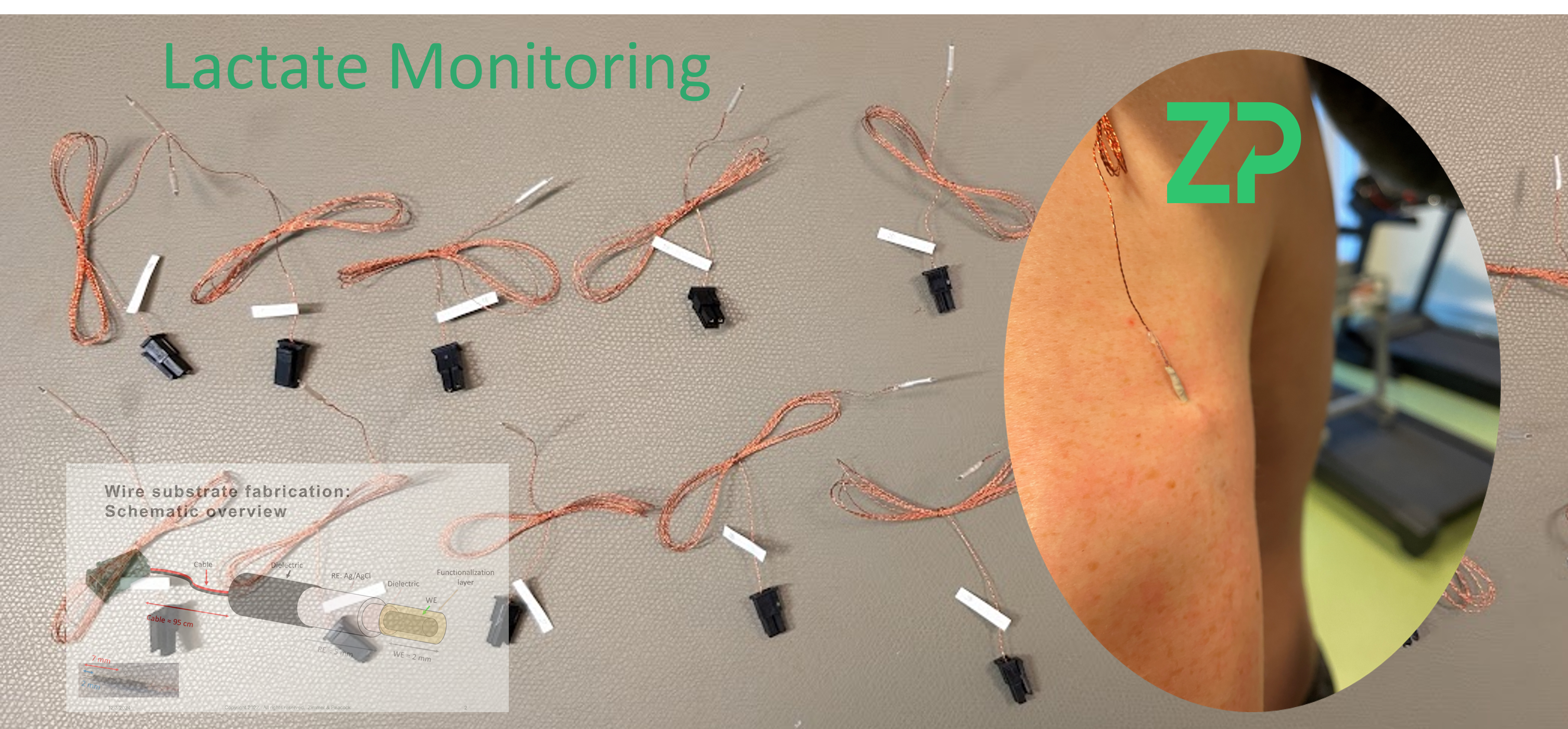 Continuous Lactate Monitoring (CLM)