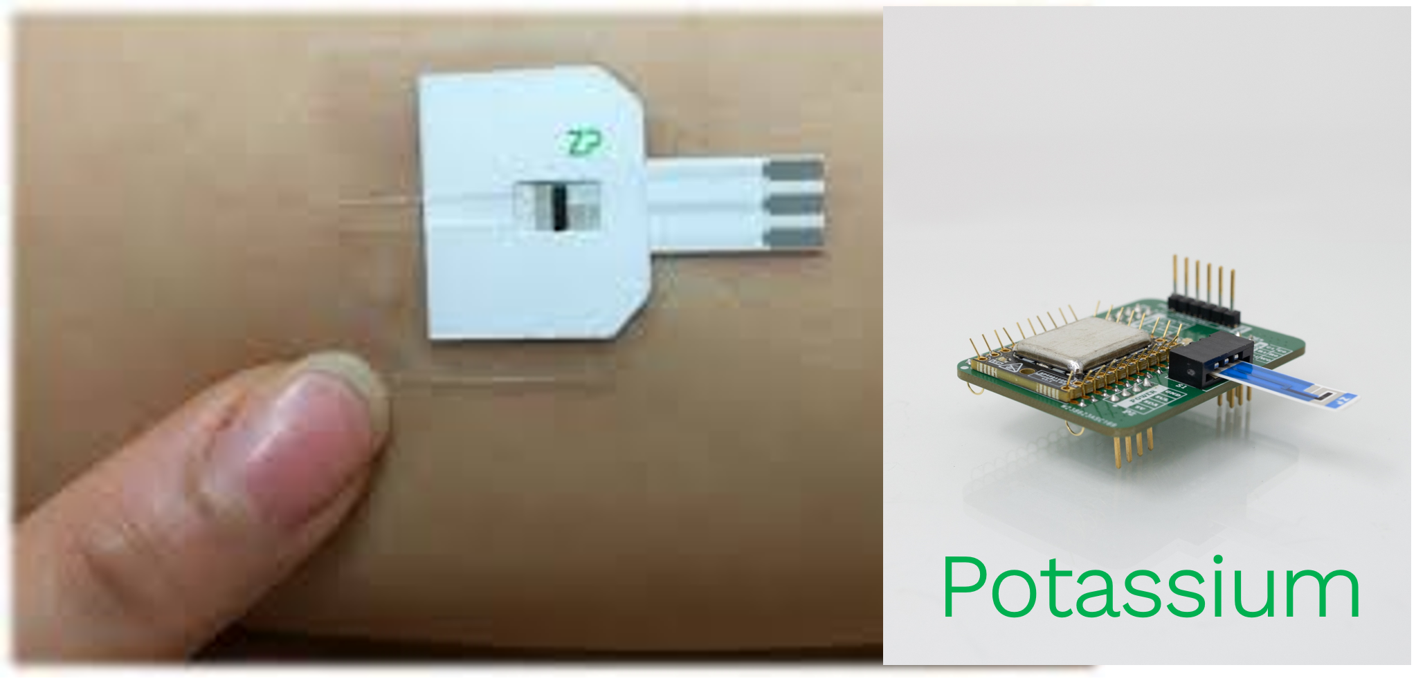 Wearable potassium sensors