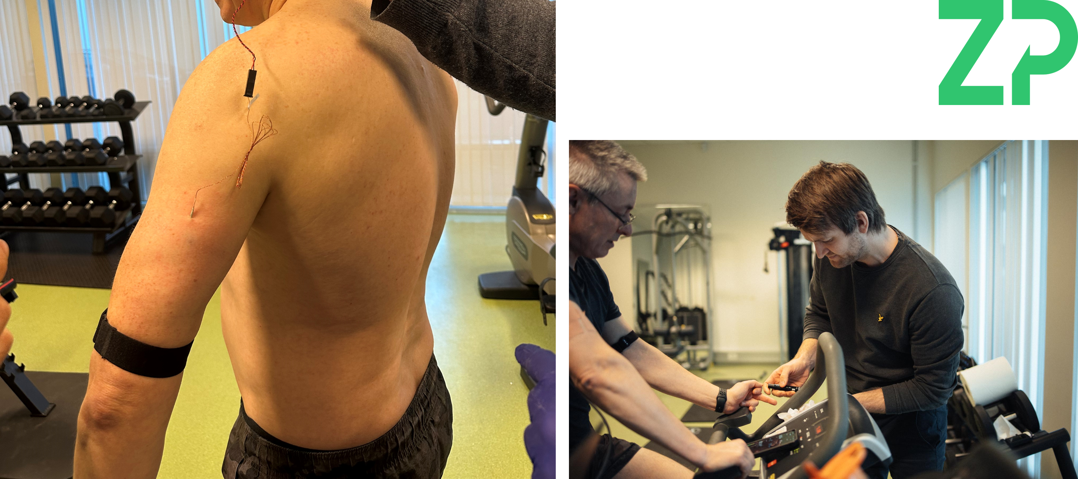 Transdermal Biosensor Technologies from ZP