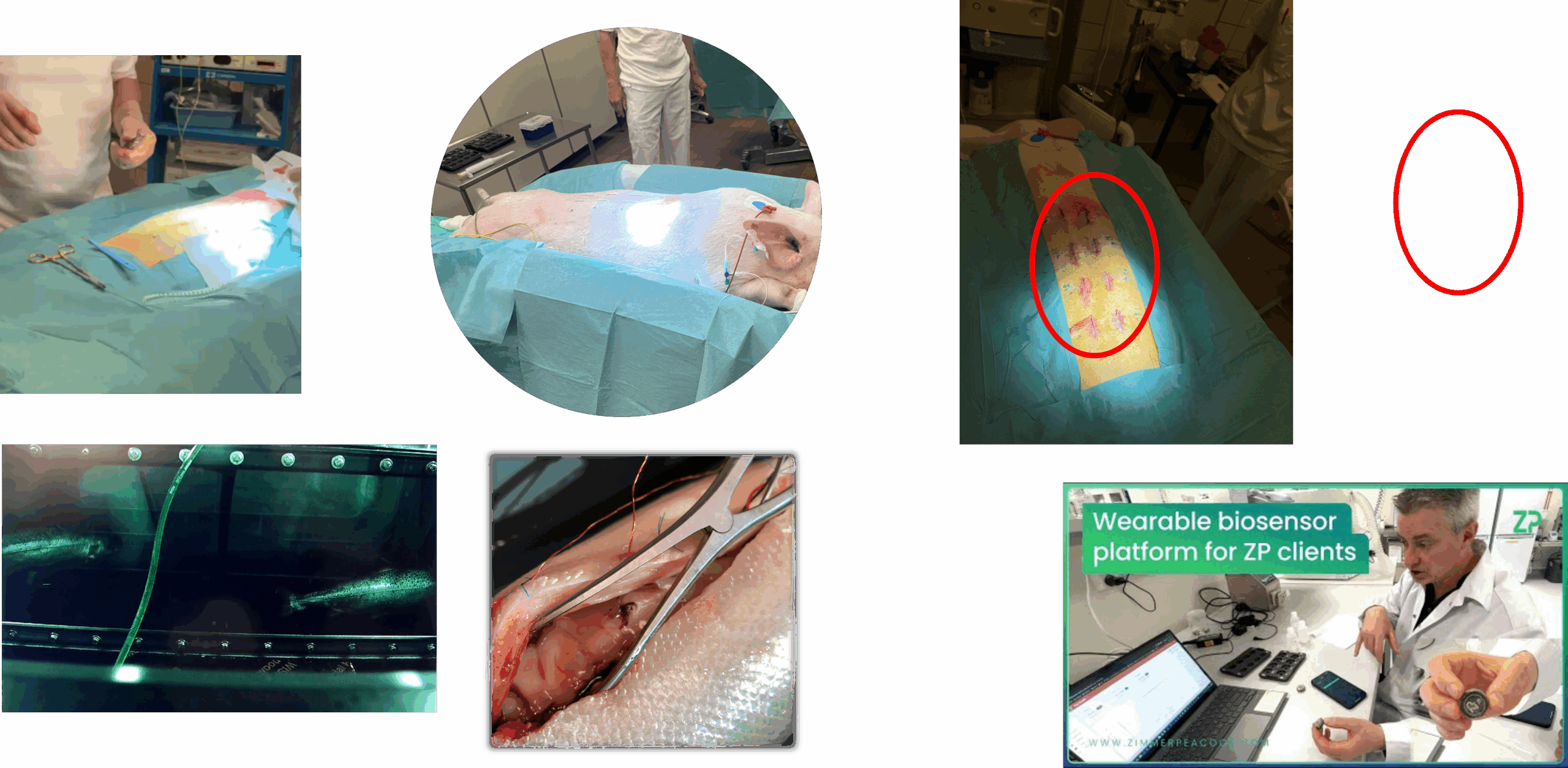 Wearable Microneedle Biosensors: A Decade of Development and Future Outlook